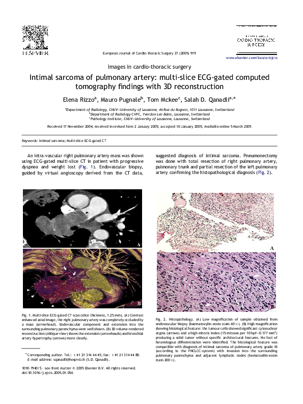 (PDF) Intimal sarcoma of pulmonary artery: multi-slice ECG-gated ...