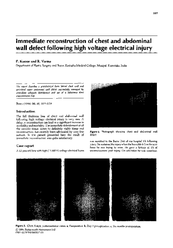 (PDF) Immediate reconstruction of chest and abdominal wall defect ...