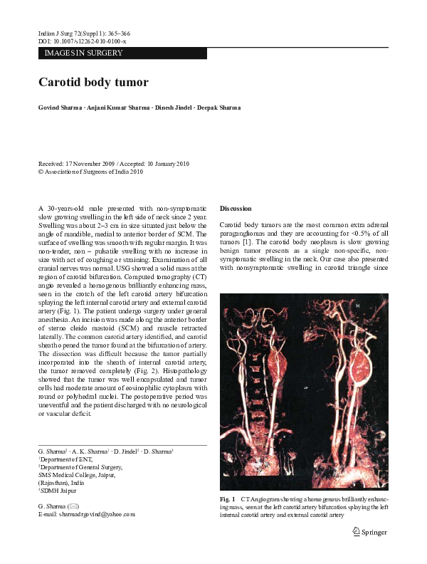(PDF) Carotid body tumor