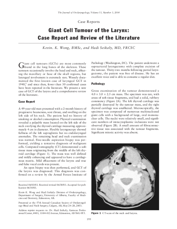 Larynx cancer picture