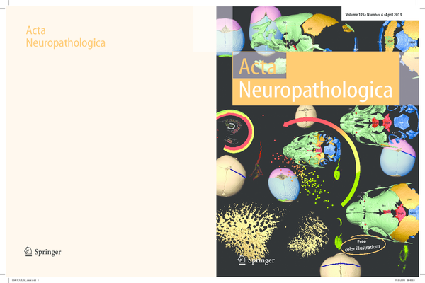 (PDF) Hand in glove: brain and skull in development and dysmorphogenesis