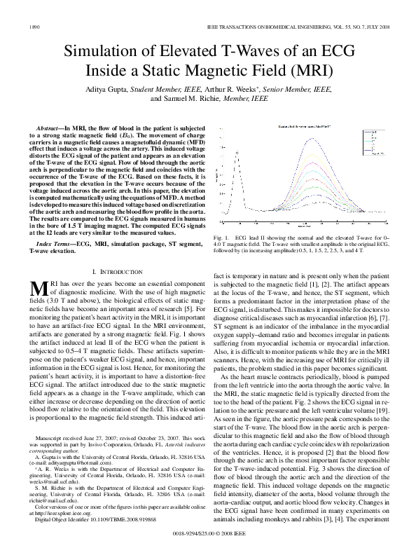 (PDF) Simulation of Elevated TWaves of an ECG Inside a Static