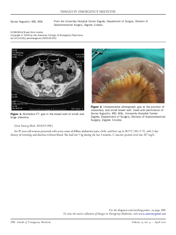 (PDF) Images in emergency medicine. Elderly woman with right thigh pain