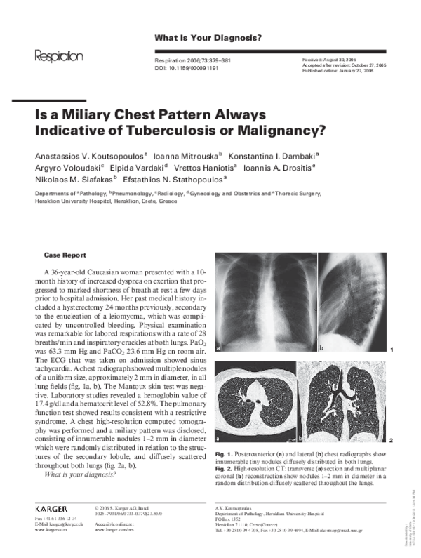 (PDF) Is a Miliary Chest Pattern Always Indicative of Tuberculosis or ...