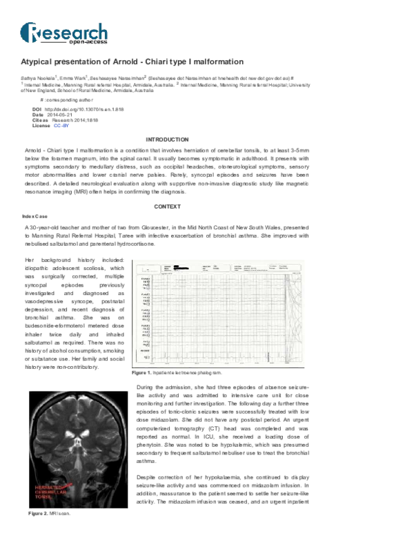 (PDF) Atypical presentation of Arnold - Chiari type I malformation