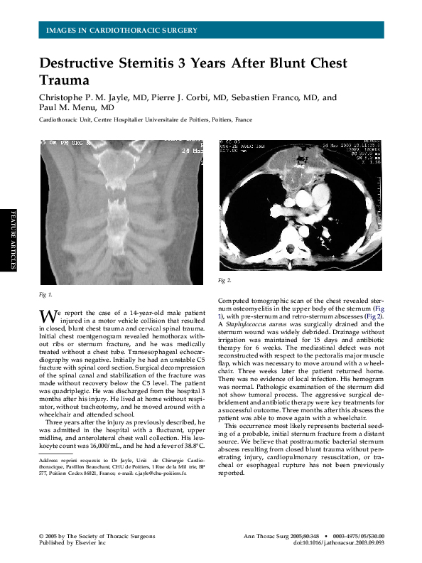 (PDF) Destructive Sternitis 3 Years After Blunt Chest Trauma