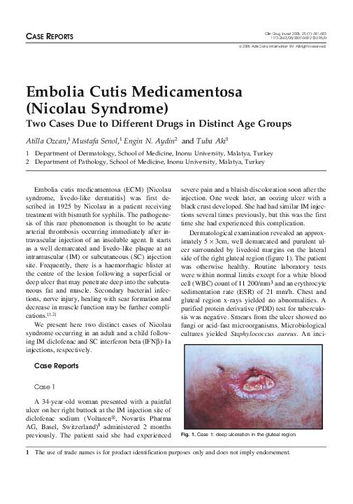 (PDF) Embolia cutis medicamentosa (nicolau syndrome) two cases due to