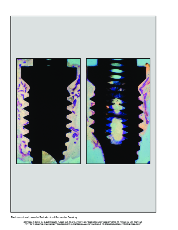 (PDF) Clinical application of bisphosphonates in implant dentistry ...