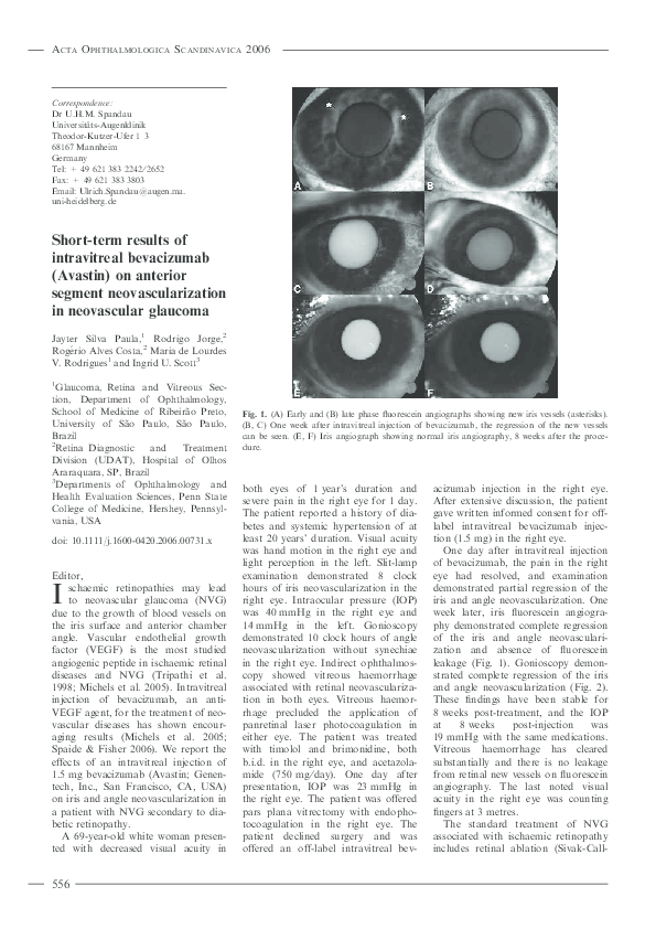 (PDF) Short-term results of intravitreal bevacizumab (Avastin) on ...