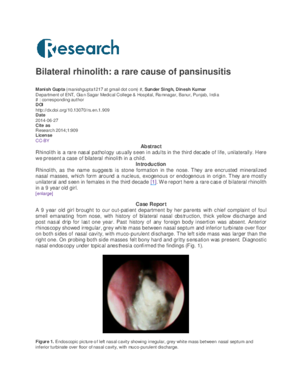 Pdf Bilateral Rhinolith A Rare Cause Of Pansinusitis Manish