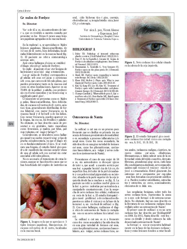 (PDF) Gránulos de Fordyce Veronica Lissett Mercado Lopez Academia.edu