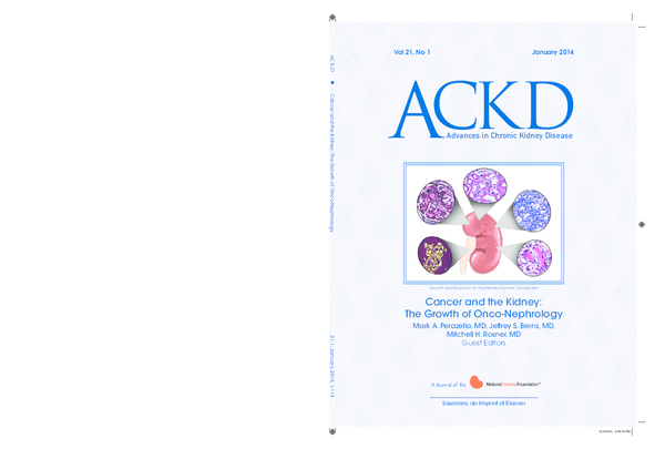 ¿Qué es un adenocarcinoma de próstata pt3 pnib pm g2 virus? ¿Qué es un adenocarcinoma de próstata pt3 pnib pm g2 virus?