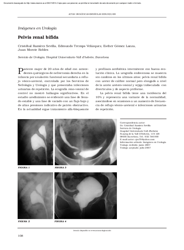 (PDF) Pelvis renal bífida
