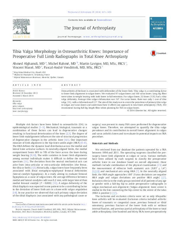 (PDF) Tibia Valga Morphology in Osteoarthritic Knees: Importance of ...