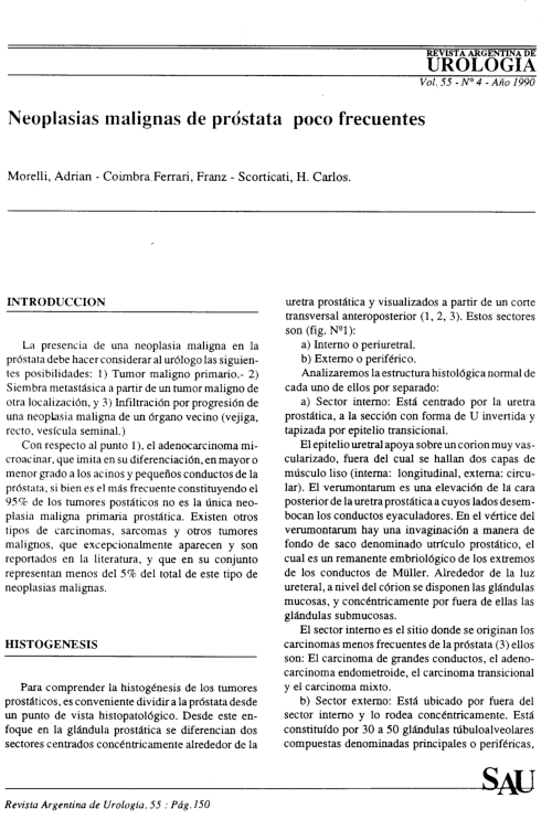 cáncer de próstata cilíndrico de células libres