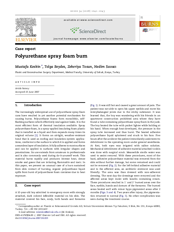 (PDF) Polyurethane spray foam burn Mustafa Keskin Academia.edu