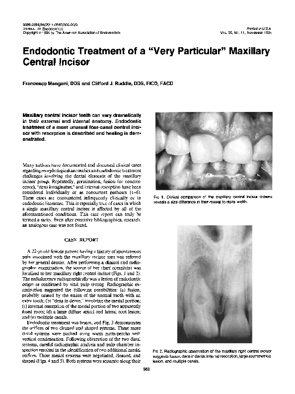 (PDF) Endodontic treatment of a “very particular” maxillary central incisor