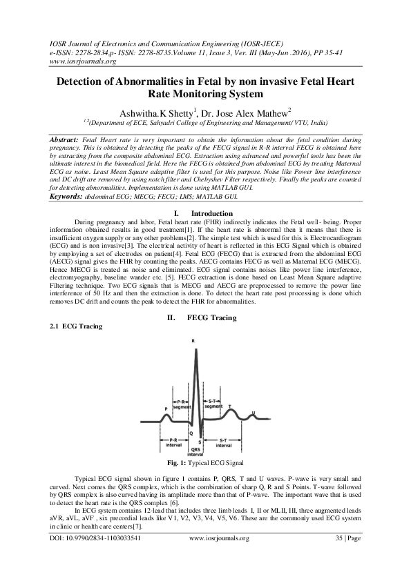 (PDF) Detection of Abnormalities in Fetal by non invasive Fetal Heart ...