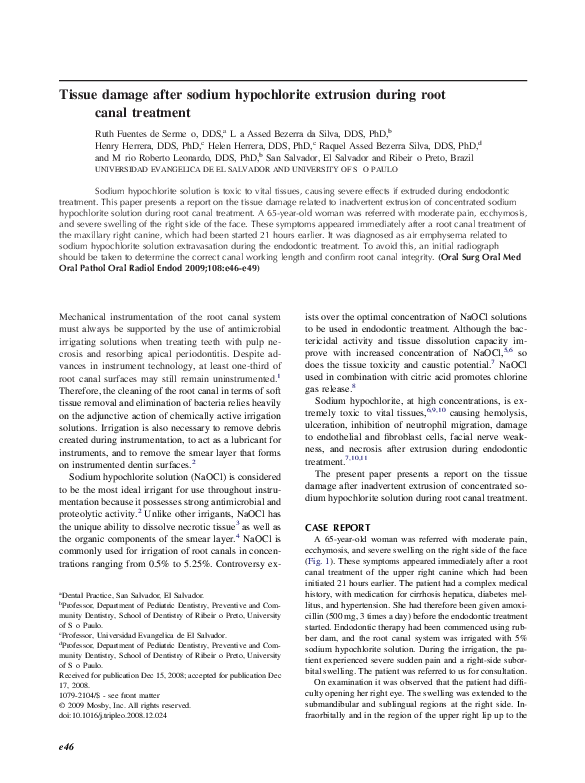 (PDF) Tissue damage after sodium hypochlorite extrusion during root