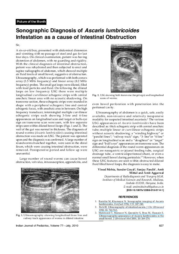 Open loop obstruction picture