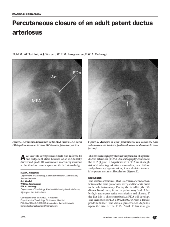 (PDF) Percutaneous closure of an adult patent ductus arteriosus