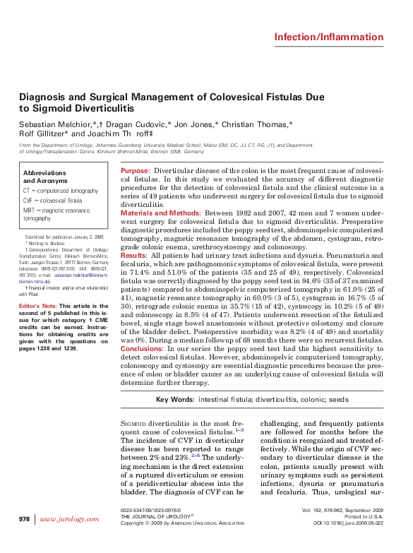 Diverticulitis life expectancy image