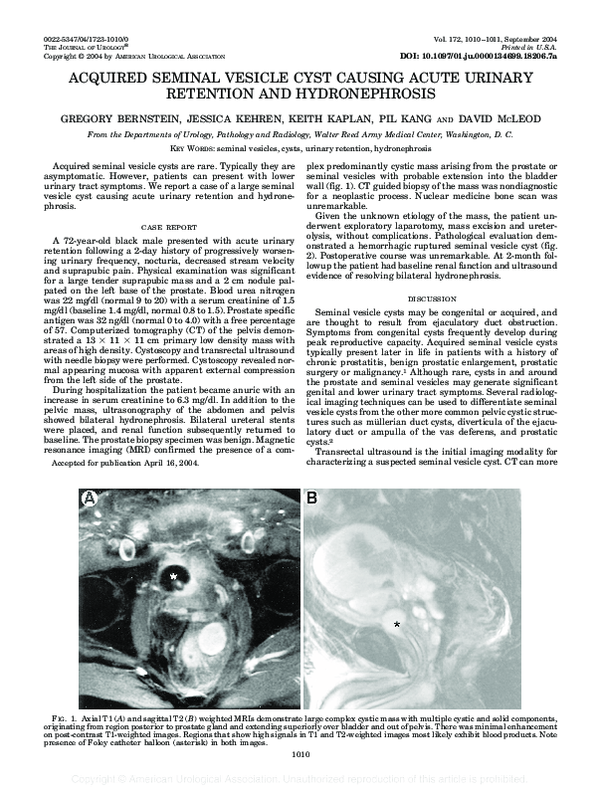 (PDF) ACQUIRED SEMINAL VESICLE CYST CAUSING ACUTE URINARY RETENTION AND ...