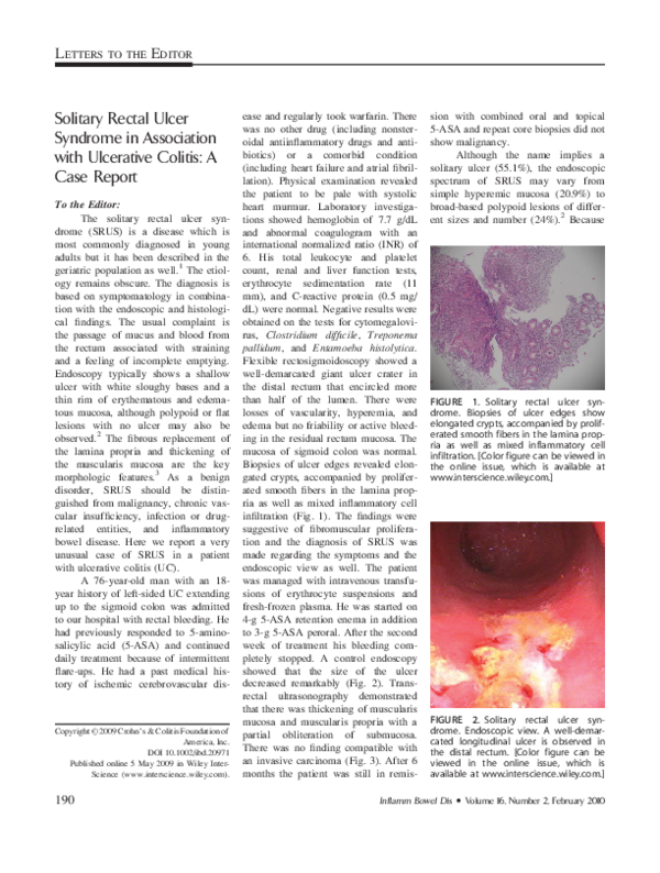 Ulcerative colitis nih image