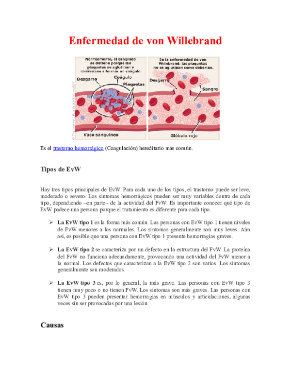 (DOC) Enfermedad de von Willebrand Ambar