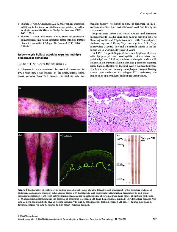 (PDF) Epidermolysis bullosa acquisita requiring multiple oesophageal ...