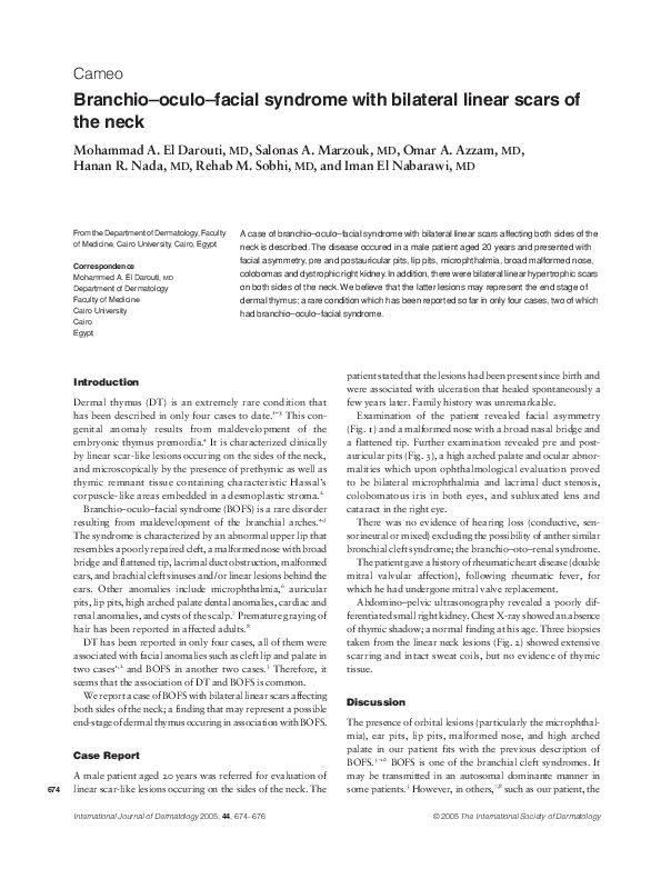 (PDF) Branchio-oculo-facial syndrome with bilateral linear scars of the ...