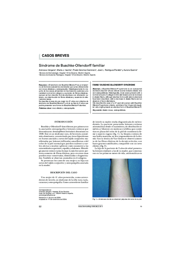 (PDF) Síndrome de BuschkeOllendorff familiar Aránzazu Vergara and