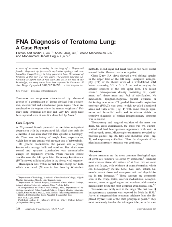 (PDF) FNA diagnosis of teratoma lung: A case report