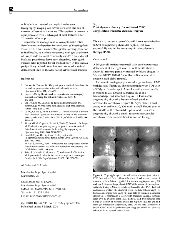 (PDF) Photodynamic therapy for subfoveal CNV complicating traumatic ...
