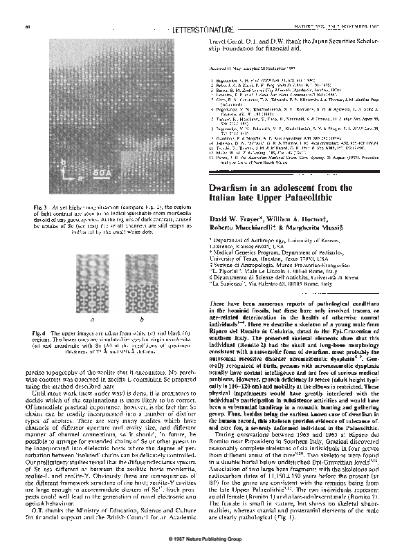 pdf dwarfism in an adolescent from the italian late upper david frayer