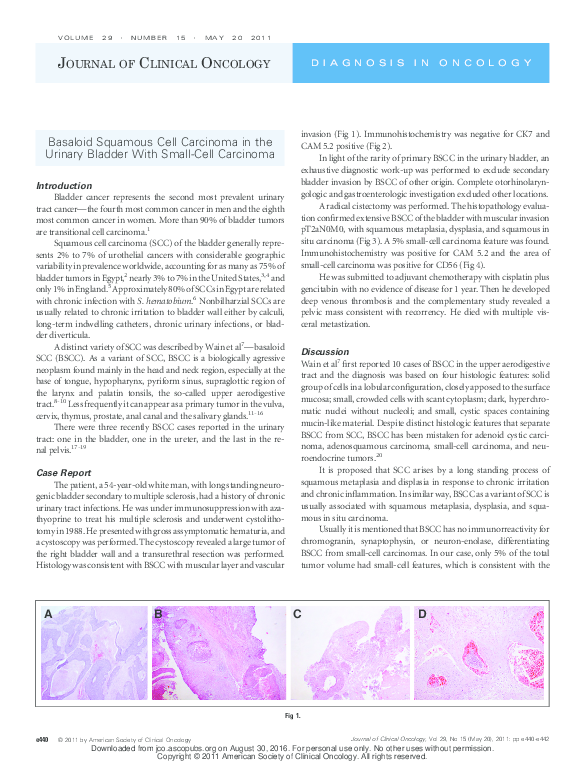 (PDF) Basaloid squamous cell carcinoma in the urinary bladder with ...