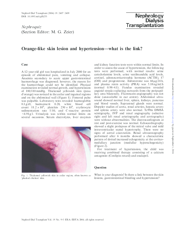 (PDF) Orangelike skin lesion and hypertensionwhat is the link? E. Sahpazova Academia.edu