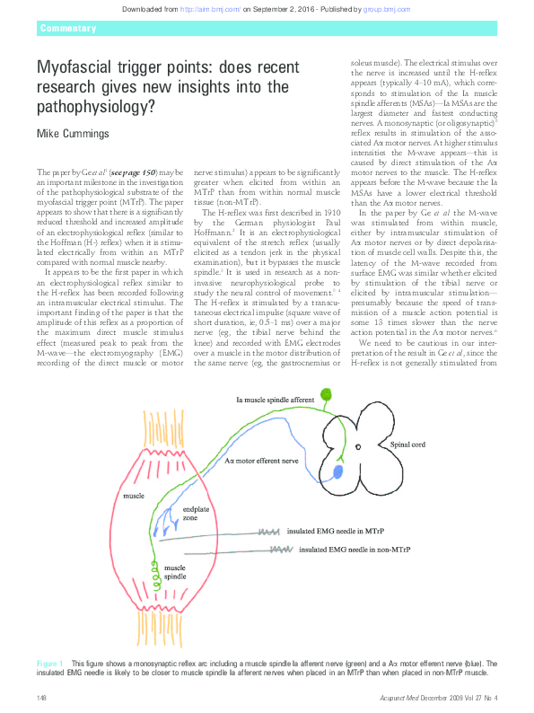 (PDF) Myofascial trigger points: does recent research gives new ...