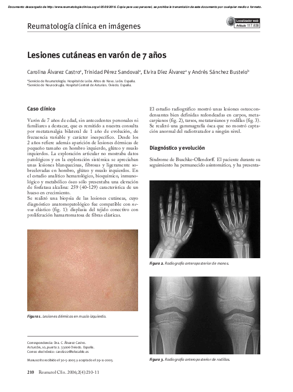 Gammagrafia Osea Pdf
