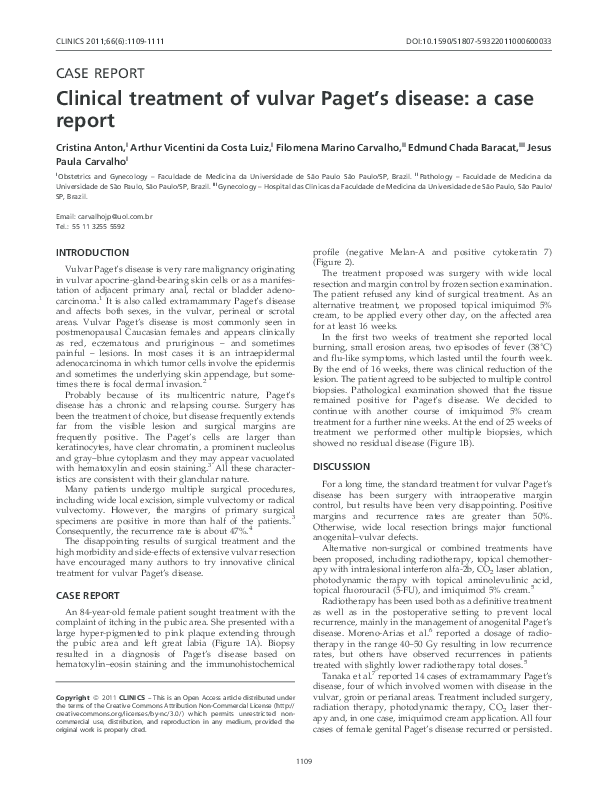 (PDF) Clinical treatment of vulvar Paget's disease a case report