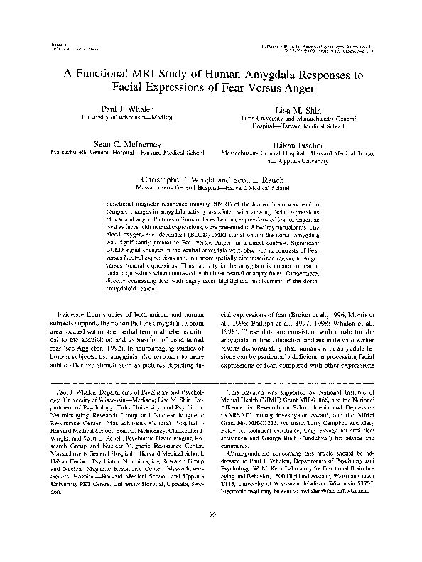 Functional mri vs regular mri image