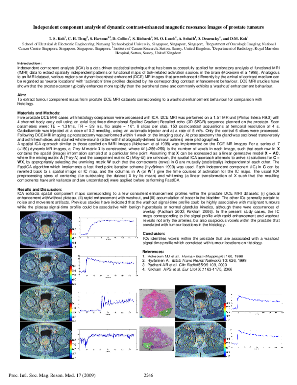 (PDF) Independent component analysis of dynamic contrast-enhanced ...