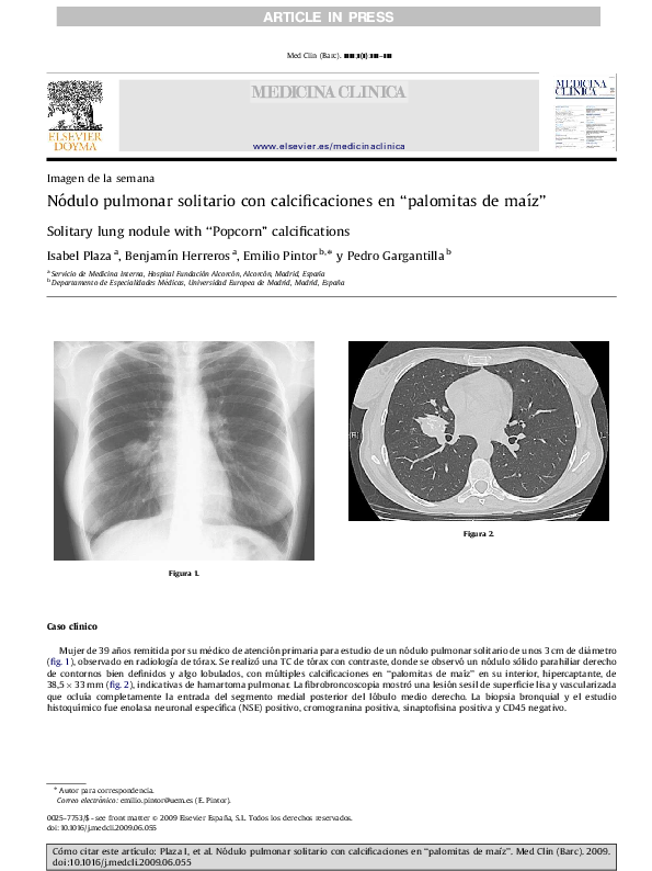 (PDF) Nódulo pulmonar solitario con calcificaciones en “palomitas de