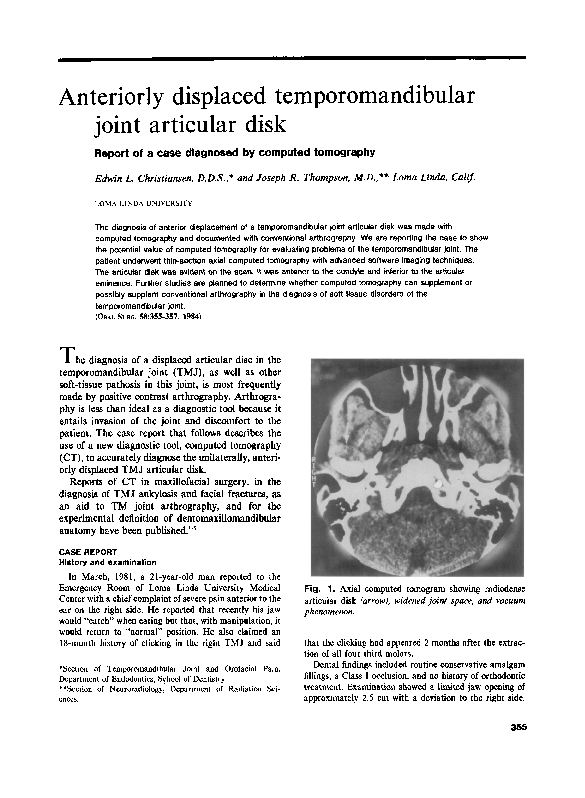 (PDF) Anteriorly displaced temporomandibular joint articular disk ...