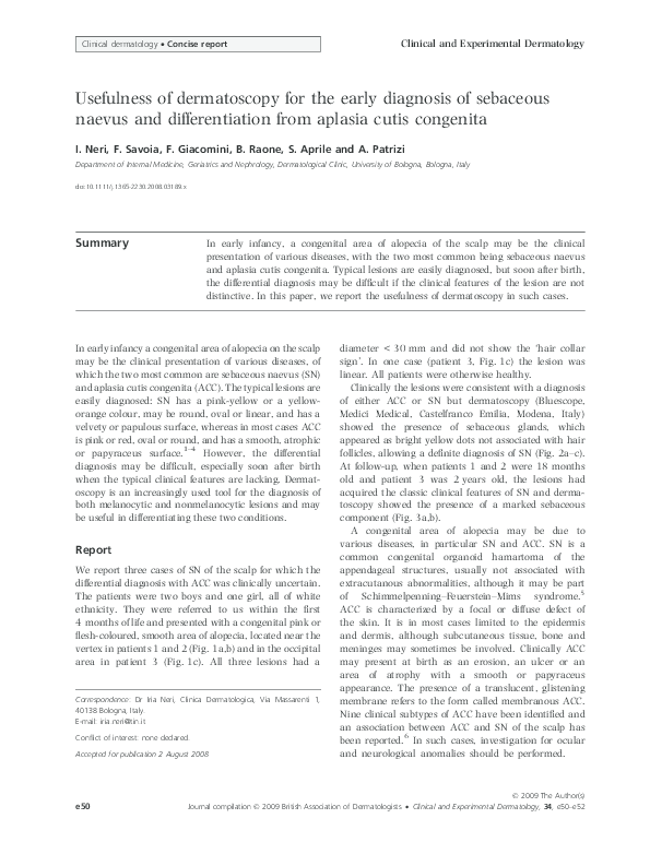 (PDF) Aplasia cutis congenita A case report and literature review