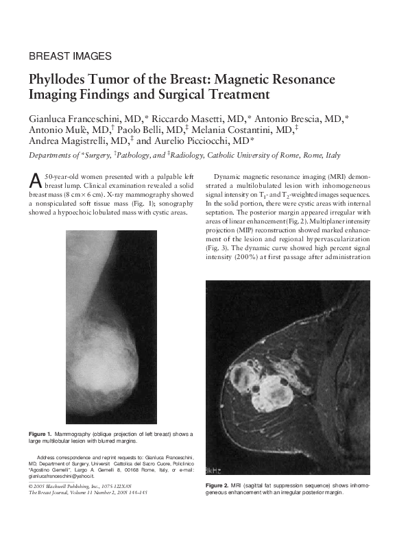Phyllodes Tumor Radiology