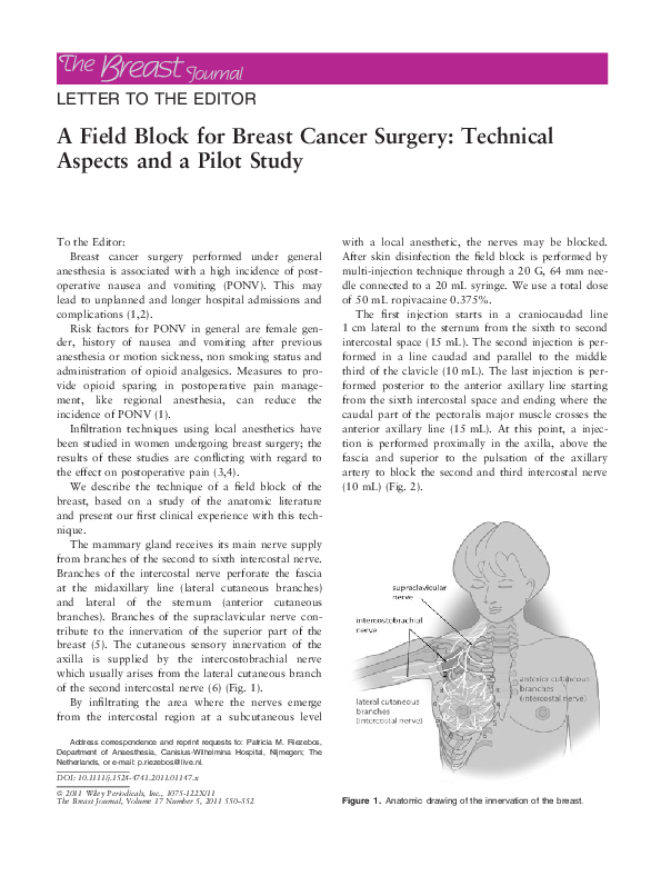 (PDF) A field block for breast cancer surgery: technical aspects and a ...