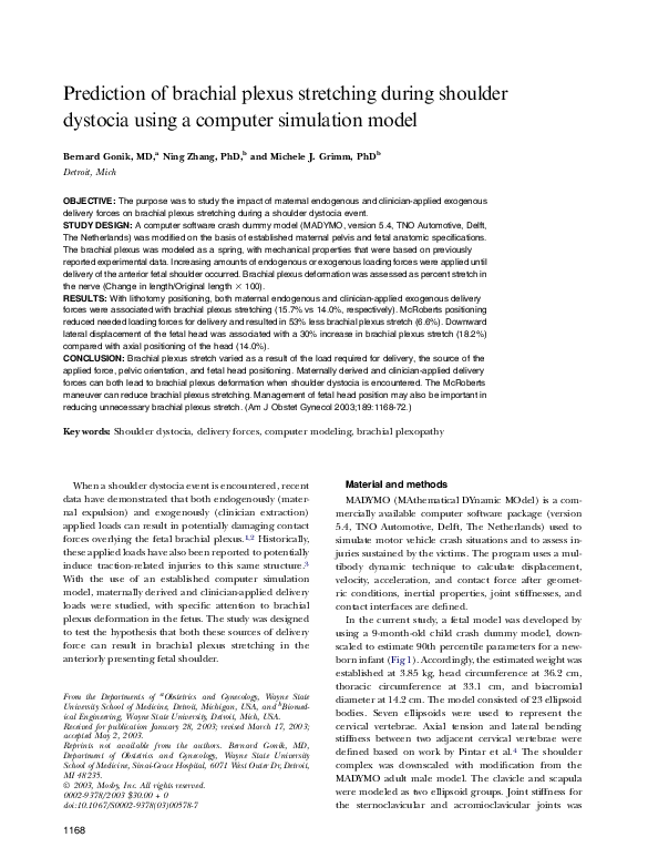 Shoulder dystocia essay image
