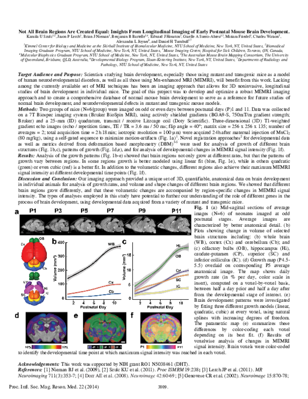 (PDF) Not All Brain Regions Are Created Equal: Insights From ...