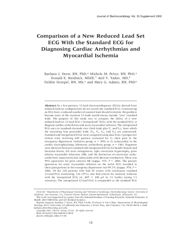 (PDF) Comparison of a new reduced lead set ECG with the standard ECG ...